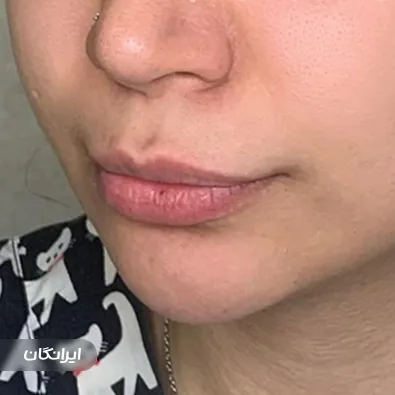 کلینیک زیبایی دکتر محبوبه یزدانی کچویی