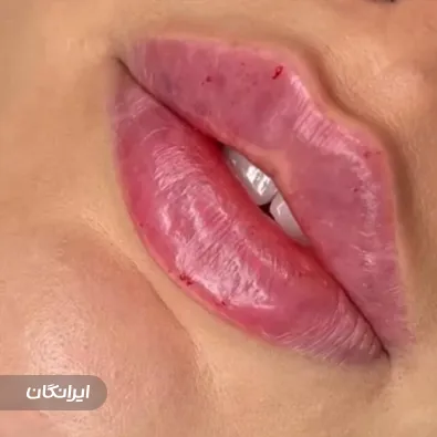 کلینیک زیبایی ورسای