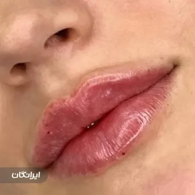 کلینیک زیبایی ورسای