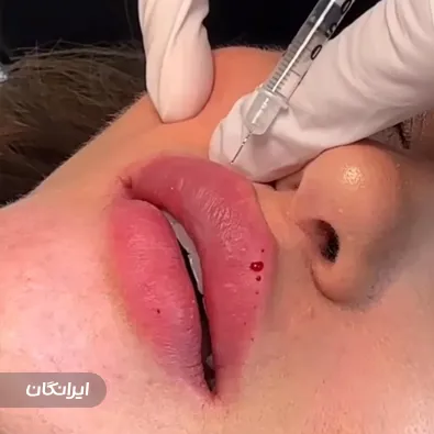 کلینیک زیبایی دکتر رضا انصاری