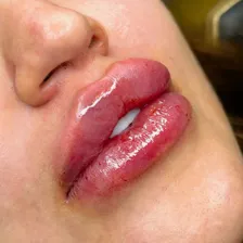 کلینیک زیبایی نئودرم