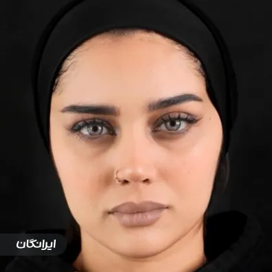 کلینیک زیبایی موگه