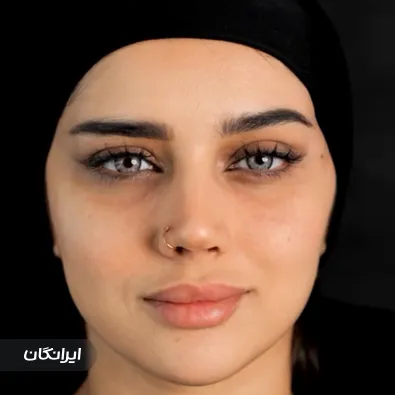 کلینیک زیبایی موگه