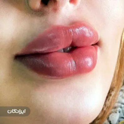 کلینیک زیبایی آلند