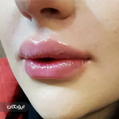 کلینیک زیبایی آلند