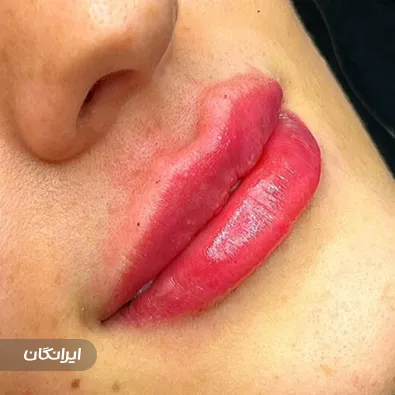 کلینیک زیبایی طراوت