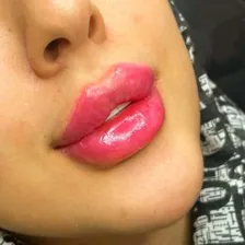 کلینیک زیبایی طراوت