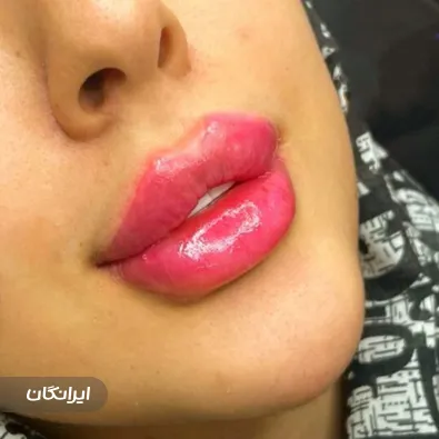 کلینیک زیبایی طراوت