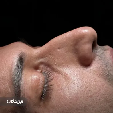 کلینیک جراحی نور بیوتی