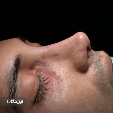 کلینیک جراحی نور بیوتی