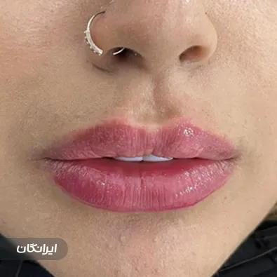 کلینیک زیبایی گوزل