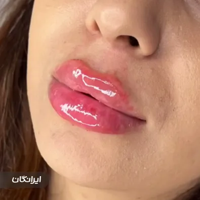 کلینیک زیبایی گوزل