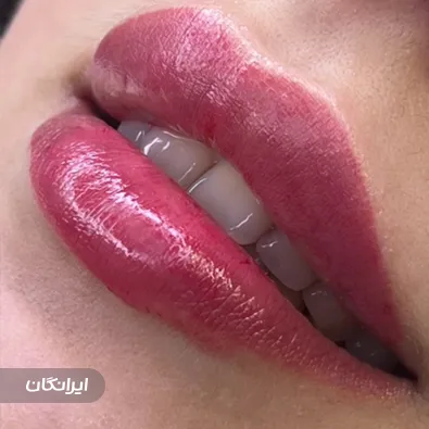 کلینیک زیبایی دکتر ایلقار رستمی