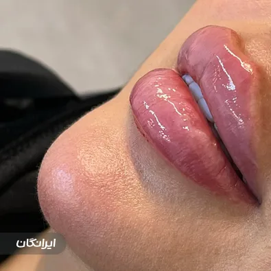 کلینیک زیبایی دکتر ایلقار رستمی