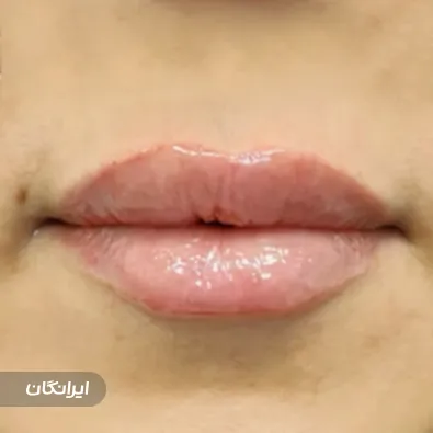 کلینیک زیبایی دکتر بهرام منصوری