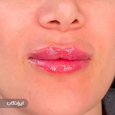 کلینیک زیبایی برنا