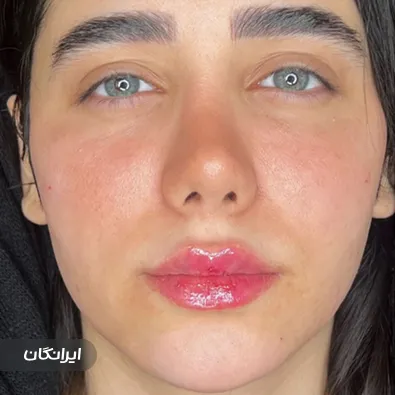 کلینیک زیبایی دکتر افشین پورنصیر