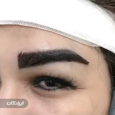 کلینیک کاشت مو تابناک