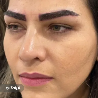 کلینیک کاشت مو تابناک