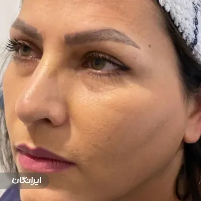 کلینیک کاشت مو تابناک