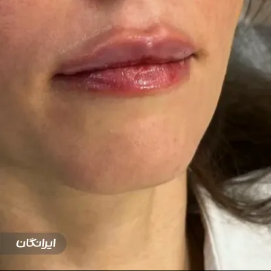 کلینیک زیبایی ترمه