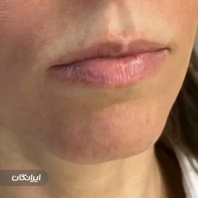 کلینیک زیبایی ترمه