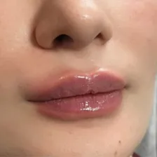 کلینیک زیبایی ترمه