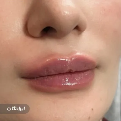 کلینیک زیبایی ترمه