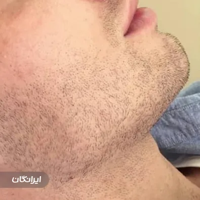 کلینیک زیبایی نیاوران بیوتی