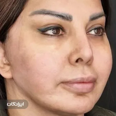 دکتر ابوالفضل عبدیزدانی