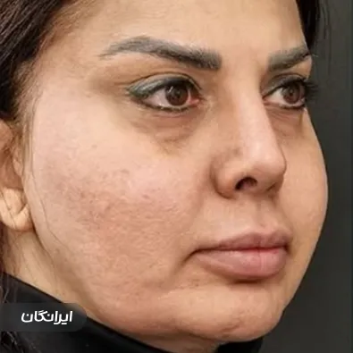 دکتر ابوالفضل عبدیزدانی