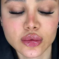 کلینیک زیبایی سیب صورتی