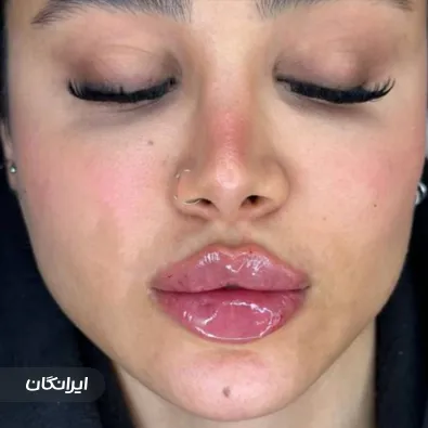 کلینیک زیبایی سیب صورتی