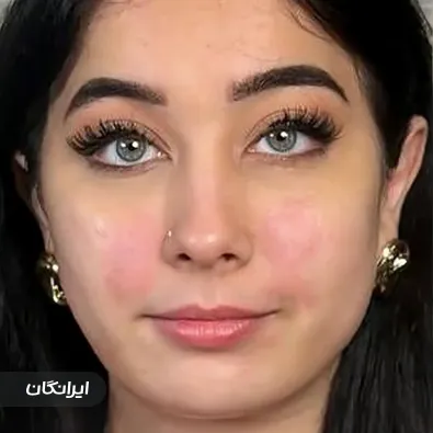 کلینیک زیبایی سیب صورتی