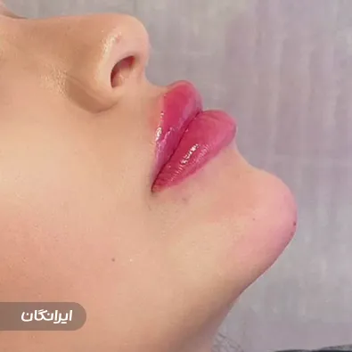 کلینیک زیبایی دکتر انسیه حسینی