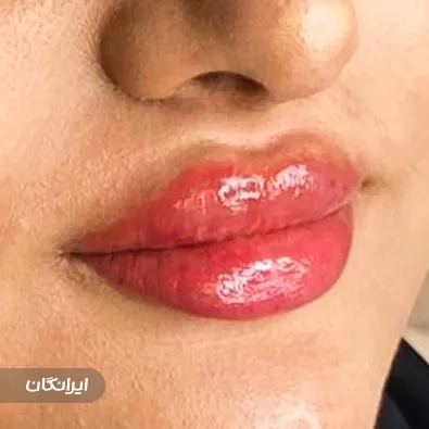 کلینیک زیبایی دکتر انسیه حسینی