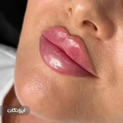 کلینیک زیبایی سروتونین