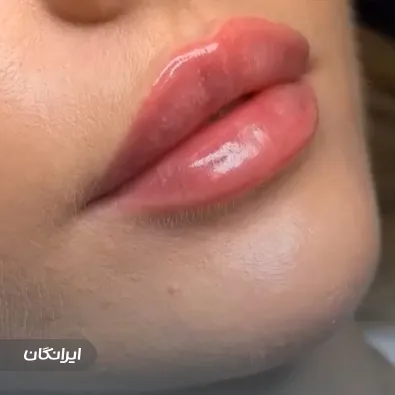 کلینیک زیبایی سروتونین