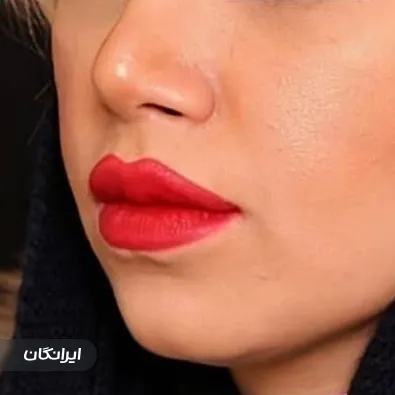 کلینیک زیبایی شکوه نارون