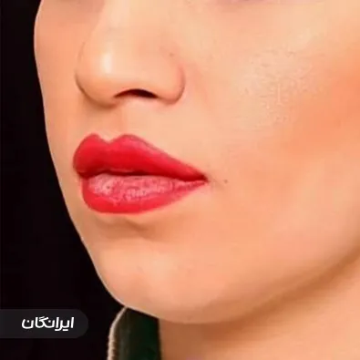 کلینیک زیبایی شکوه نارون