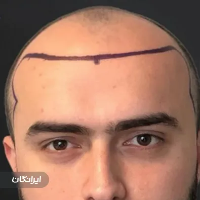 کلینیک زیبایی پرنیان