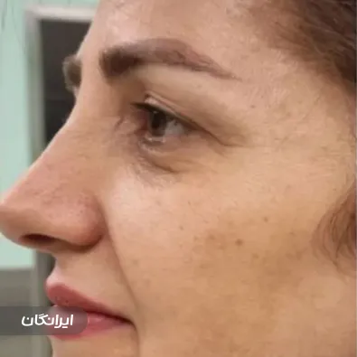 کلینیک جراحی ایران بیوتی