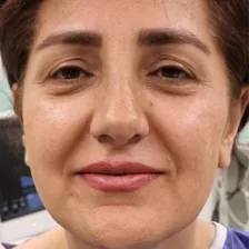 کلینیک جراحی ایران بیوتی