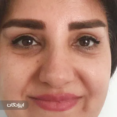 کلینیک جراحی ایران بیوتی