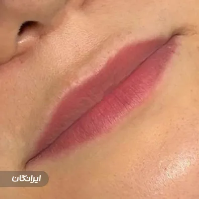 کلینیک زیبایی نسیم