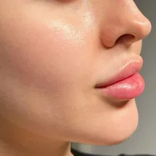 کلینیک زیبایی سونریسا