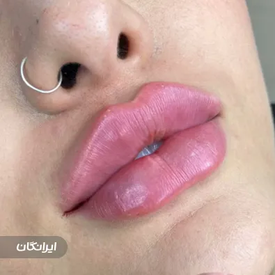 کلینیک زیبایی اسپرلوس