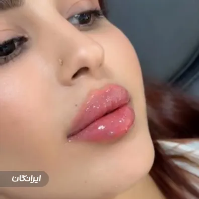 کلینیک زیبایی هانا