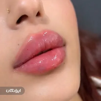 کلینیک زیبایی هانا