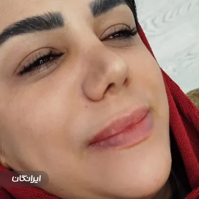 کلینیک زیبایی و لیزر نسیم قیطریه